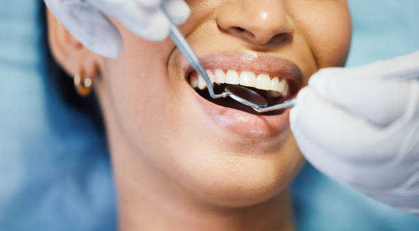 Best Walk-In Emergency Dentist in Garyville, LA